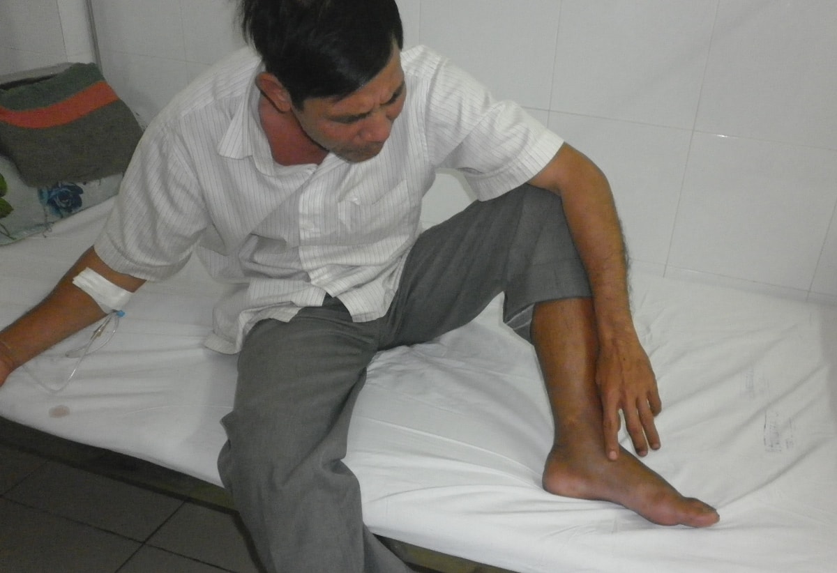 Ông Ngô Văn Hùng cho rằng nọc của rắn lục đuôi đỏ quá độc, không thể dùng các loại lá chữa trị rắn cắn đắp vào như khi bị rắn lục bản địa cắn.