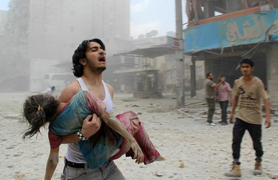 Bức ảnh em bé Syria bị thương nặng trong một vụ đánh bom tại một nhà thờ Hồi giáo ở thành phố Aleppo ở Syria.