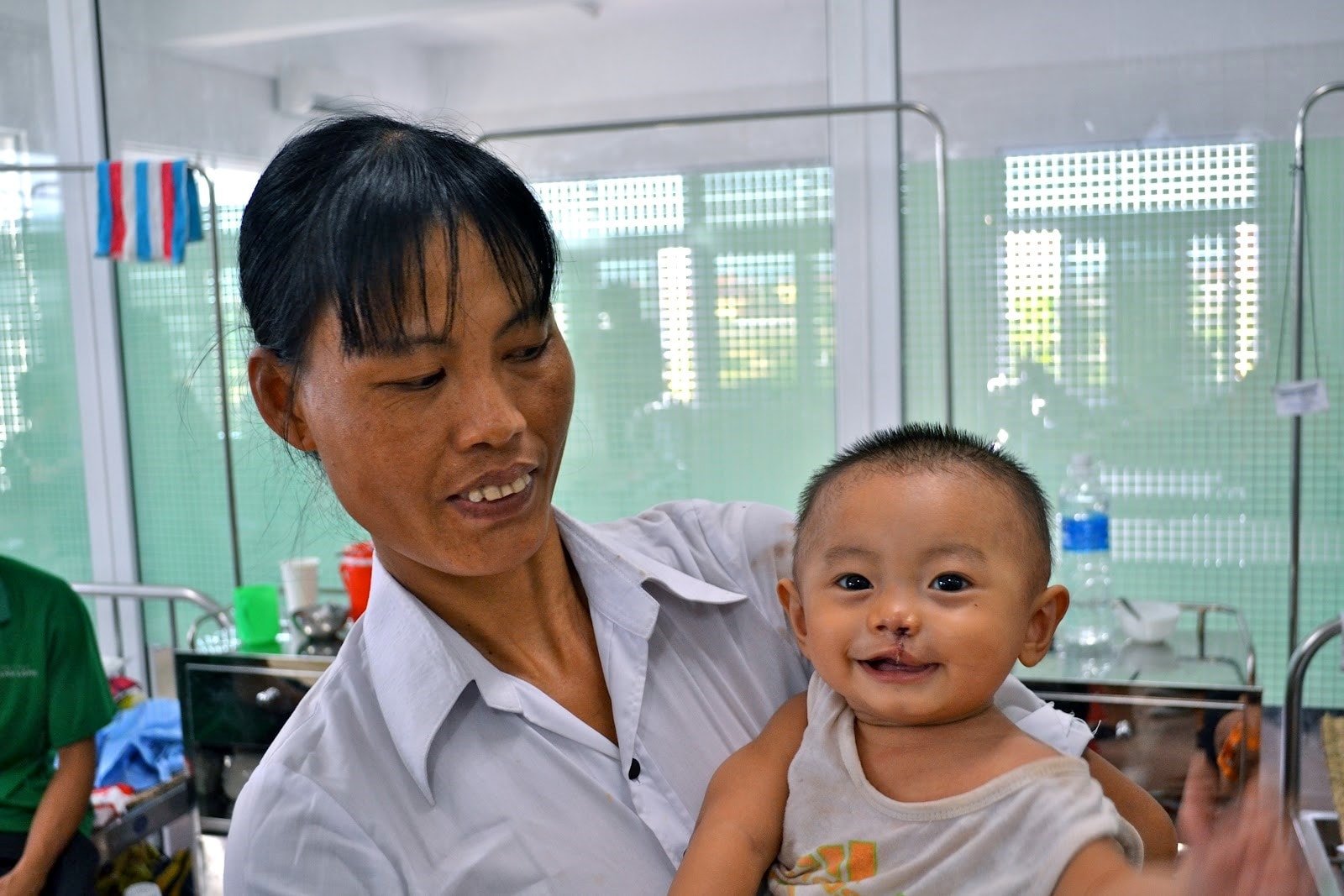 Cleft lip and cleft palate surgeries for children smiles. Photo: operationsmilevietnam2012