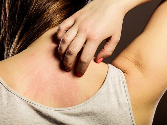 Ngứa da: Phát ban da không phải lúc nào cũng liên quan tới các khối u ác. Nhưng trường hợp có một khối u ác ở tử cung có thể gây ngứa. Ung thư não có thể gây ngứa ở lỗ mũi.