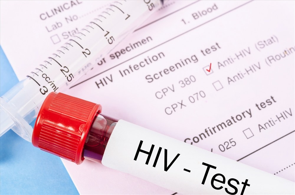 Một mẫu xét nghiệm HIV. Ảnh: nfectiousdiseaseadvisor