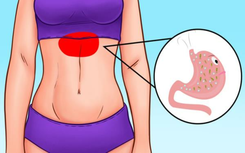 Đau nhẹ trên dạ dày: Nếu bạn đang trải qua cơn đau bụng âm ỉ phía trên dạ dày (phần bụng trên) kèm cảm giác đầy hơi thì tình trạng này có nghĩa là bạn đang có khí dư thừa trong dạ dày.