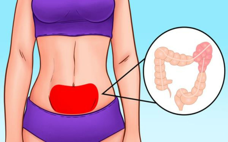 Đau dưới rốn kèm chuột rút, đầy hơi: Đây là triệu chứng của hội chứng ruột kích thích. Khi mắc hội chứng này, vùng dưới rốn của bạn thường xuyên bị đau kèm biểu hiện chuột rút và đầy hơi.