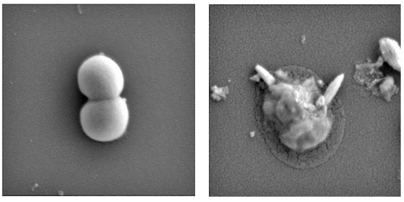 Tụ cầu vàng kháng thuốc (hình bên trái), bị hạt nano kim loại phá nát (bên phải)