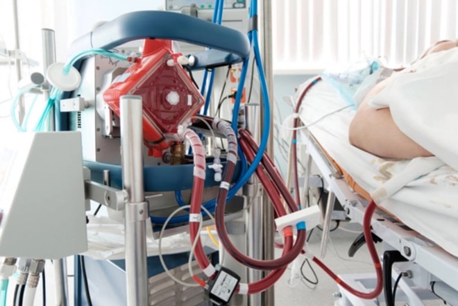 Hệ thống máy hỗ trợ ECMO trong thực tế. Nguồn: Internet