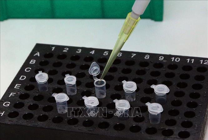 Test xác định virus SARS-CoV-2. Ảnh minh họa: Dương Giang/TTXVN