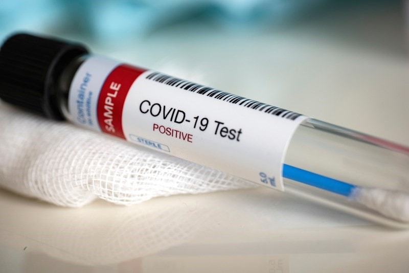 Xét nghiệm virus Covid-19 (Minh họa)