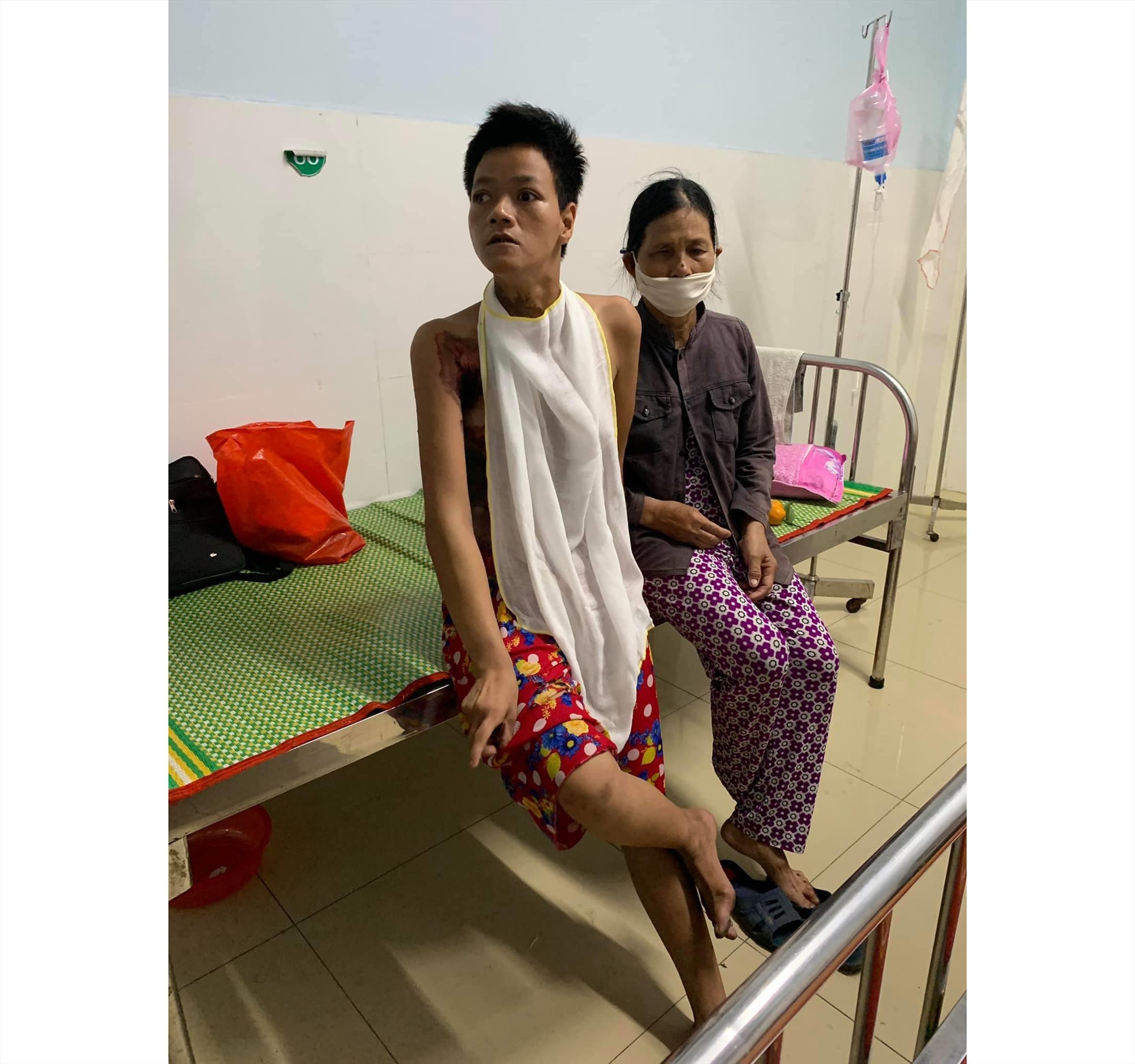 Chị Thanh bị bỏng nặng đang điều trị tại Bệnh viện Đà Nẵng. Ảnh: B.N