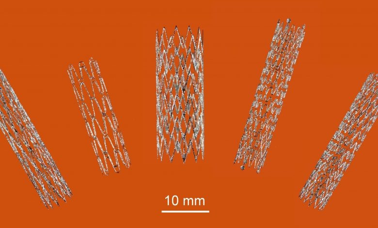 Stent được chế tạo bởi công nghệ in 3D