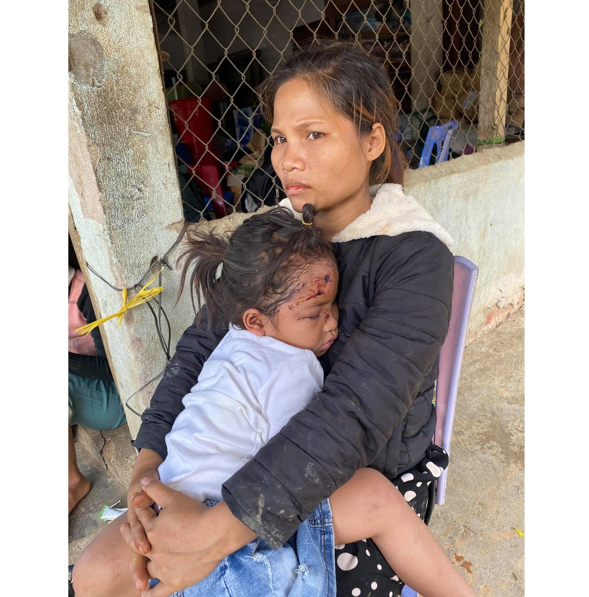 Chị Hồ Thị Hà bồng bế con gái 5 tuổi còn đầy thương tích trên khuôn mặt