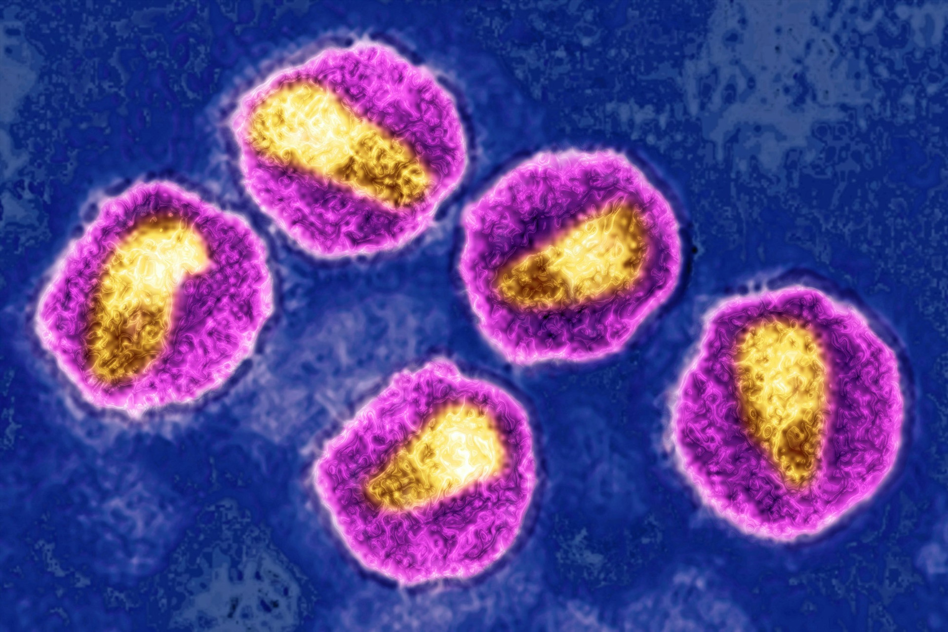 Hình ảnh vi rút HIV thông qua kính hiển vi điện tử. Ảnh:gettyimages