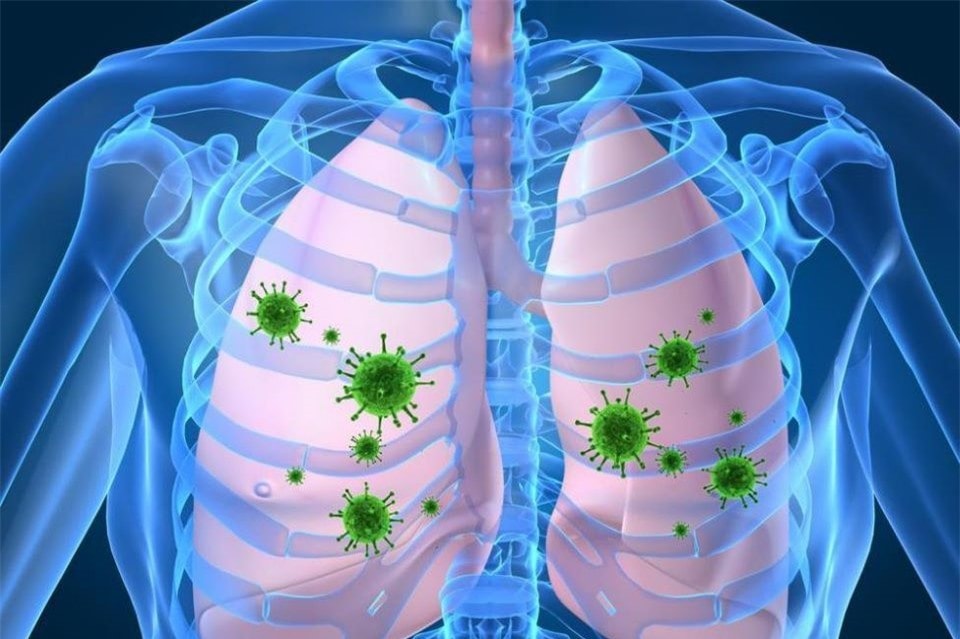 Viêm phổi Lipid gây phá hủy các phế nang, gây xơ hóa phổi,có thể dẫn đến suy hô hấp không hồi phục, rất nguy hiểm.