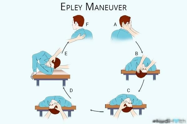 Phương pháp Epley maneuver được các bác sĩ vật lý trị liệu khuyên áp dụng tại nhà chữa chóng mặt.