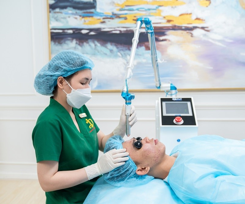 Ứng dụng công nghệ Plasma lạnh trong quá trình điều trị sẹo rỗ.