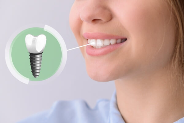 Trồng răng Implant mang lại hiệu quả thẩm mỹ và chức năng ăn nhai gần như răng thật, mà không gây xâm lấn hay làm tổn hại đến các răng còn lại.