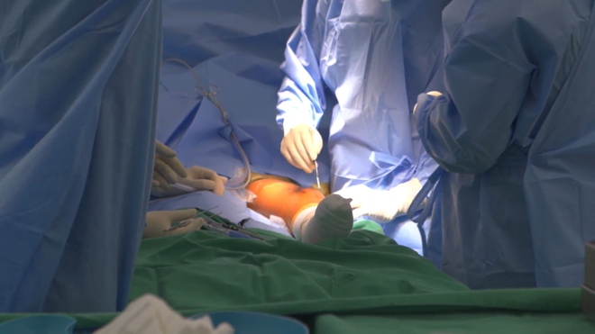 Bệnh nhân ung thư xương đầu tiên tại Việt Nam được phẫu thuật bảo tồn chi thay khớp tăng trưởng.