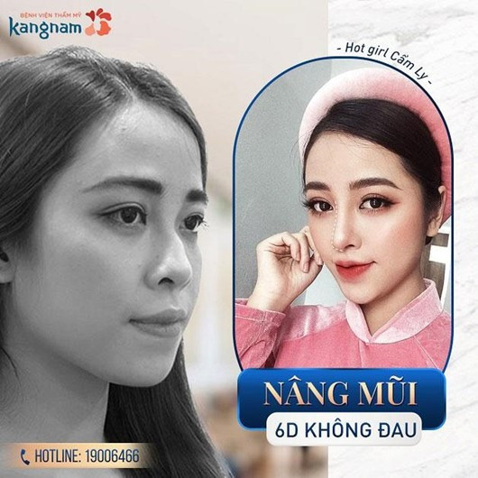 Sở hữu dáng mũi đẹp hoàn hảo với công nghệ 6D tiên tiến.