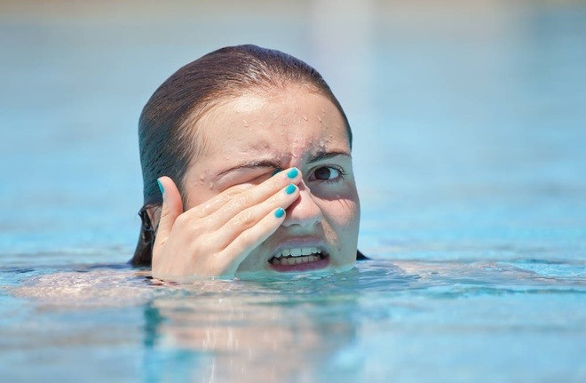 Nếu không bảo vệ mắt cẩn thận khi đi bơi, bạn dễ gặp các vấn đề về mắt như khô, nhiễm trùng, kích ứng. Ảnh: Anchopools.