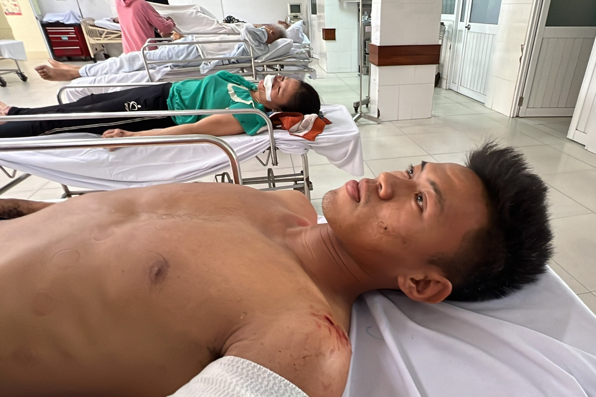 Cầu thủ Lương Quang Huy đang nằm điều trị tại Bệnh viện Đa khoa Quảng Nam. Ảnh: A.S