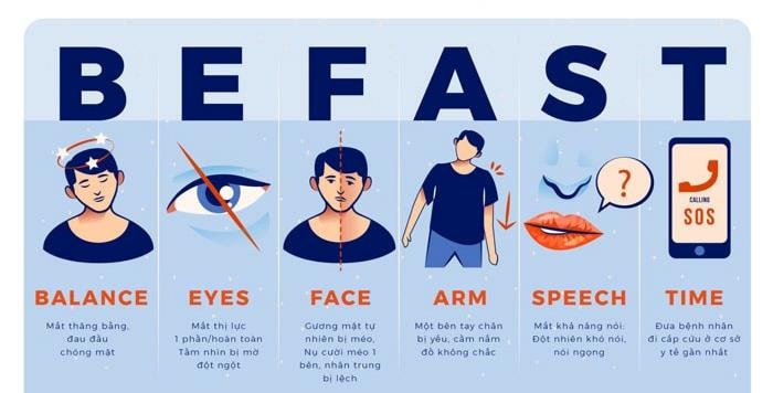 Dấu hiệu nhận biết sớm đột quỵ theo thuật ngữ FAST – Hội đột quỵ Hoa Kỳ