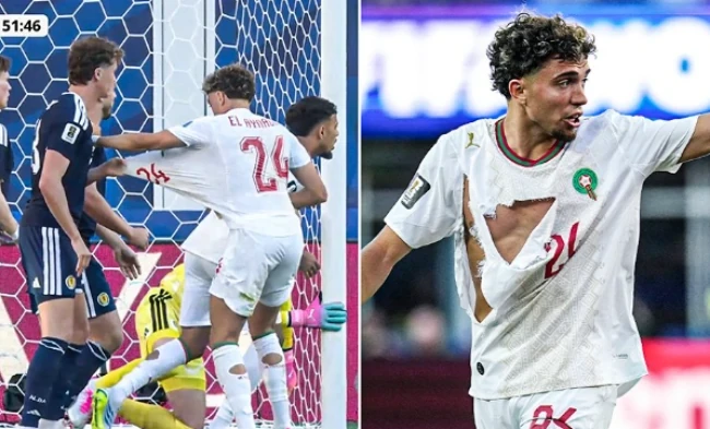 Áo đấu của El Aynaoui bị rách