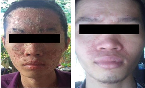 Chữa bệnh bằng thuốc nam