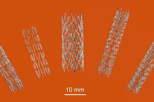 Phát triển giá đỡ mạch máu stent nhờ công nghệ in 3D