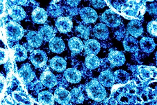 Phát hiện cây hương nhu chứa chất ức chế sự phát triển của virus SARS-CoV 2