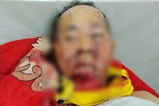 Một trưởng thôn người Cơ Tu bị gấu tấn công trên đường đi làm về nhà