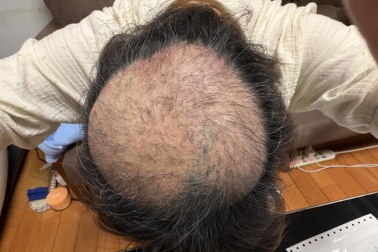 Đài Bắc: Tiệm đậu hũ thối gây tranh cãi vì khiến người dân rơi vào trạng thái hoảng loạn