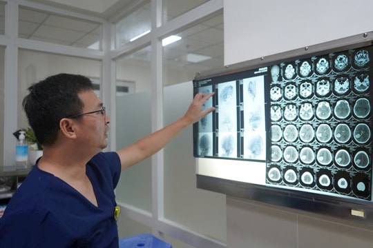 Cảnh giác với đột quỵ mùa nắng nóng