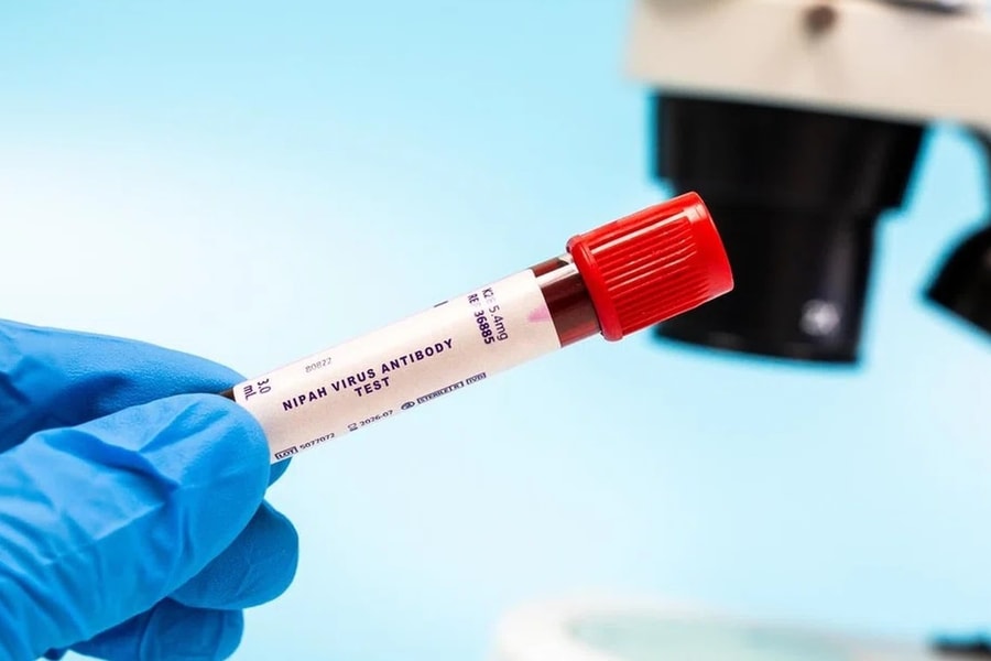 WHO: Nguy cơ lây lan virus Nipah từ Ấn Độ ở mức thấp