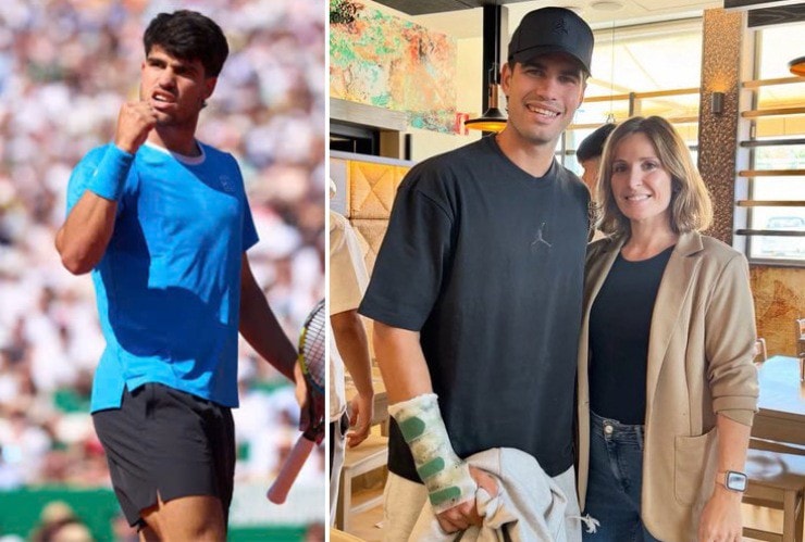 Carlos Alcaraz nẹp cố định cổ tay phải và bỏ ngỏ khả năng tham dự Roland Garros 2024