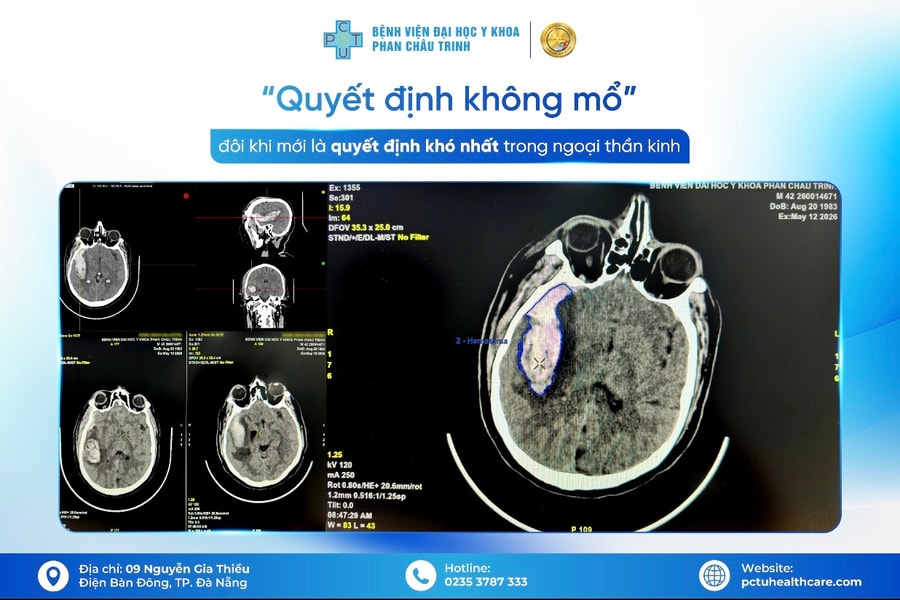 Quyết định không mổ đôi khi là quyết định khó nhất trong Ngoại thần kinh