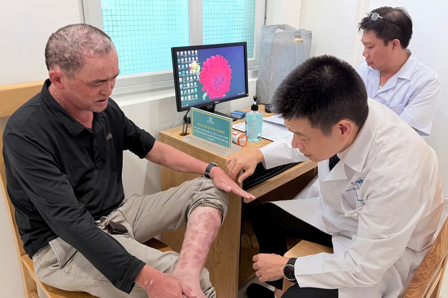Bệnh viện 199 khai trương Phòng khám chuyên đề bệnh vảy nến