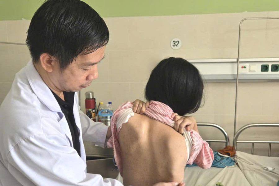 Bệnh viện Đà Nẵng tầm soát miễn phí vẹo cột sống cho trẻ em