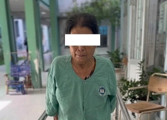 Thay khớp gối toàn phần thành công cho ca bệnh thoái hóa và vẹo trục nặng
